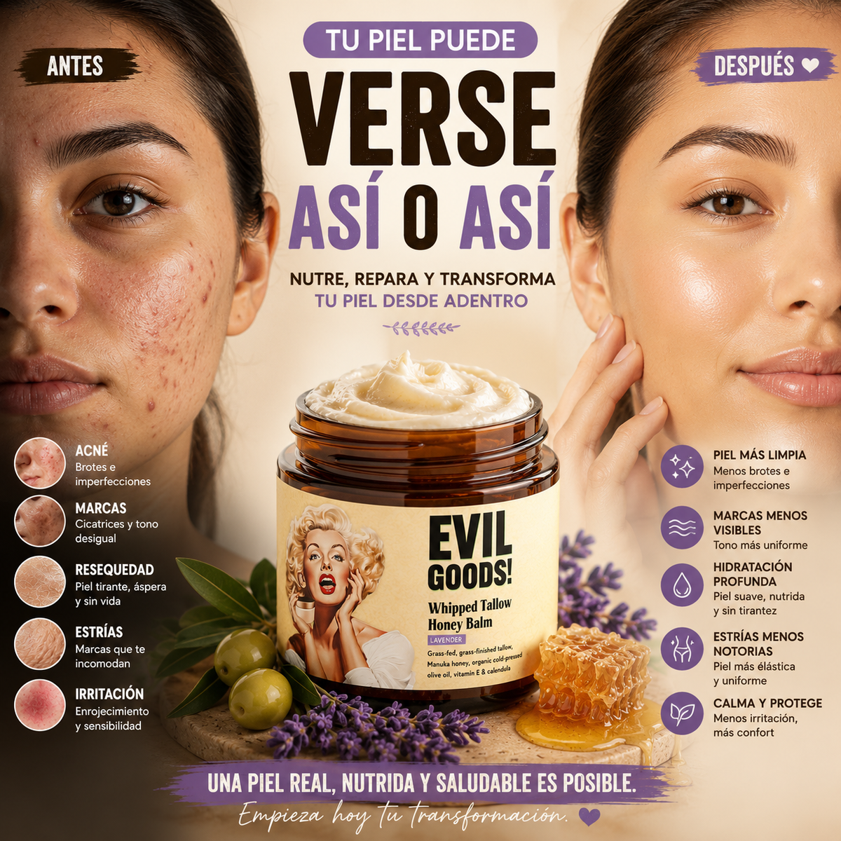 (55% Descuento) Crema Hidratante Natural EVIL GOODS ORIGINAL – Adiós Acné y Piel Seca